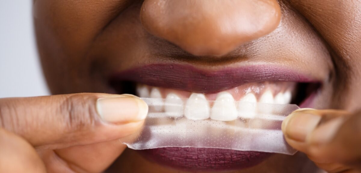 Should You Brush Your Teeth After Using Whitening Strips